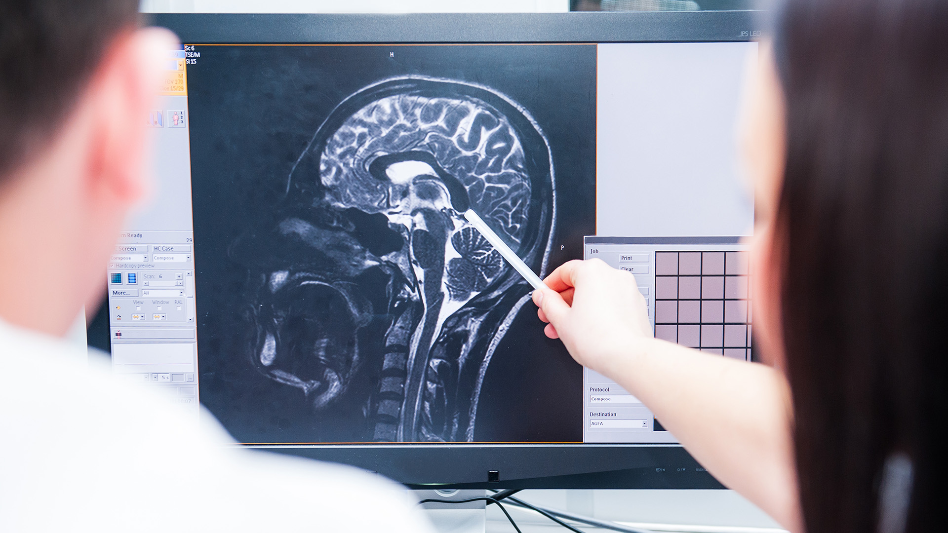 Two professionals examining a brain scan