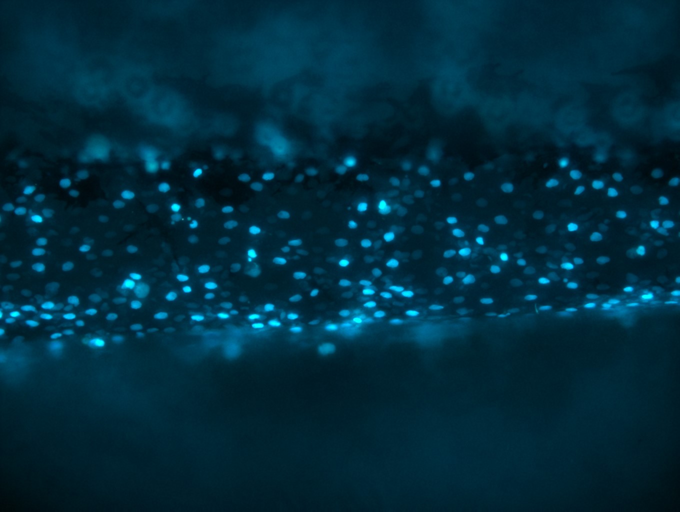 Close up of the FUS protein. Dark irregular cylindrical strand going from left to right, covered in pale blue dots.