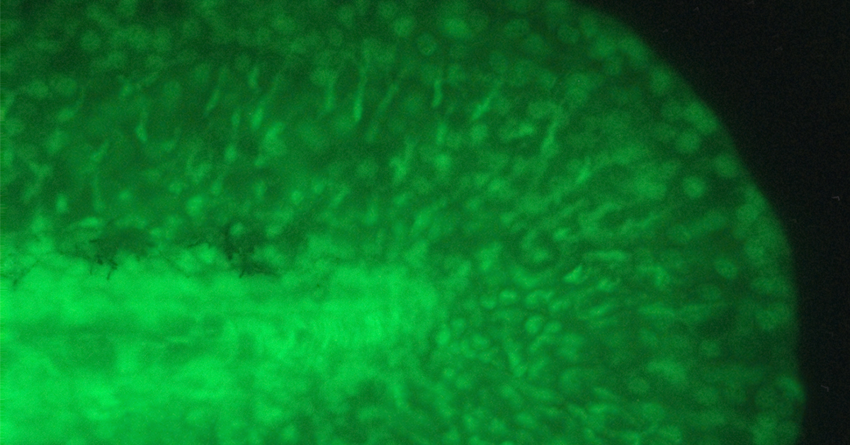 FUS protein highlighted in green. Close up of strand is in the middle of green sphere, with black background.