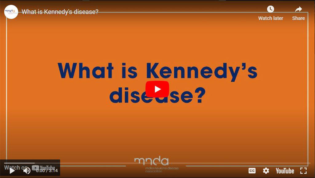 What is Kennedy's disease animation