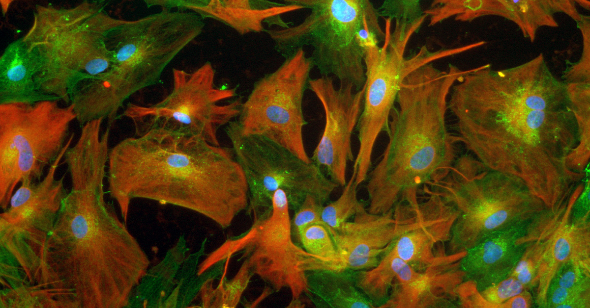 Close up of astrocyte cells. Red and green elongated star shapes, with blue circular shapes in the middle. Dark background.