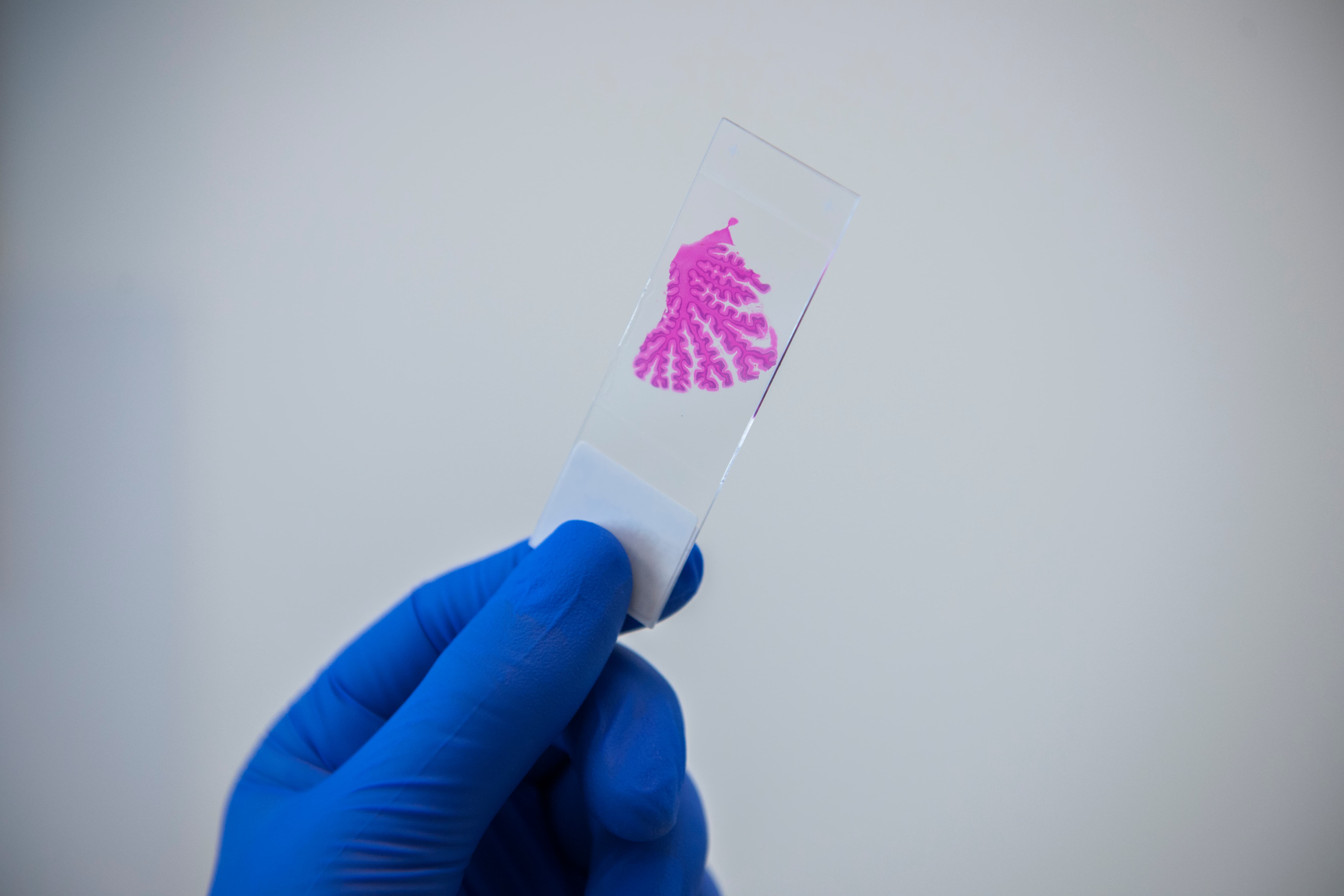 Gloved hand holding a lab slide with pink sample