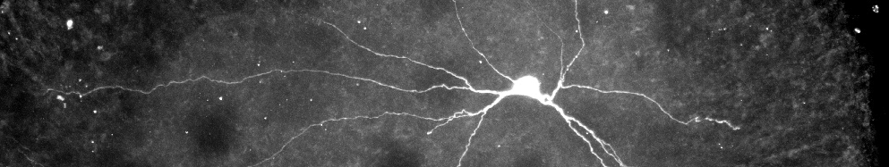 A black and white image of a motor neuron.