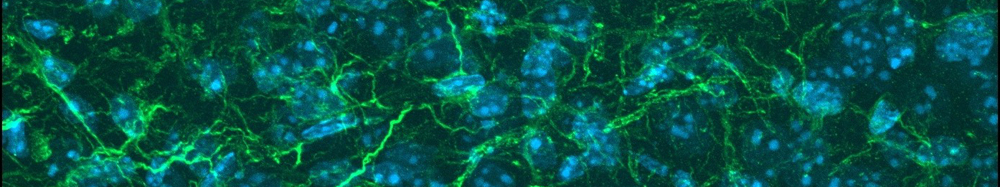 Glial cells in the brain. Green and blue colours.
