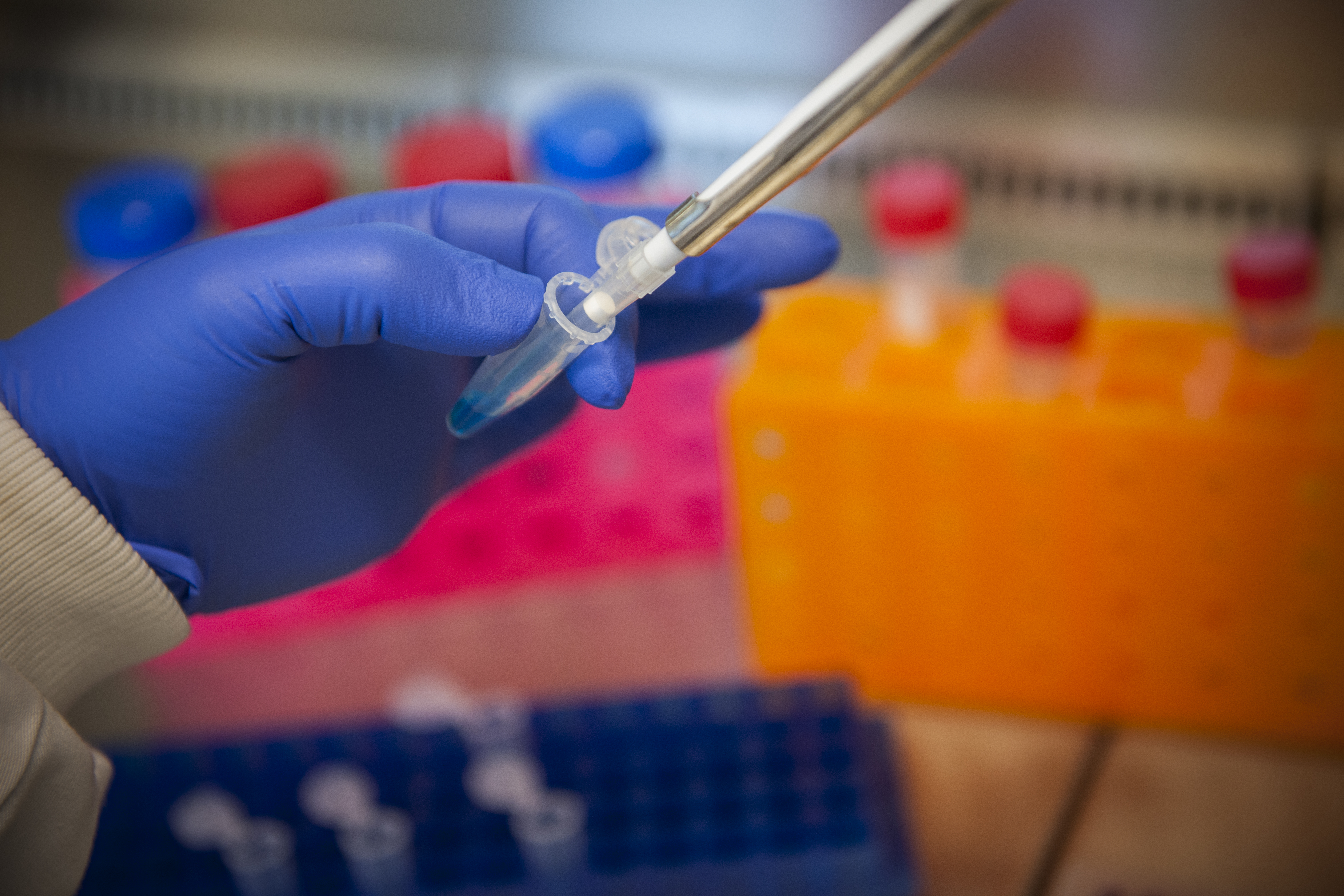 Hand holding a tube and pipette