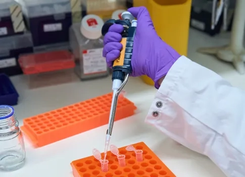 A hand and a pipette in the lab